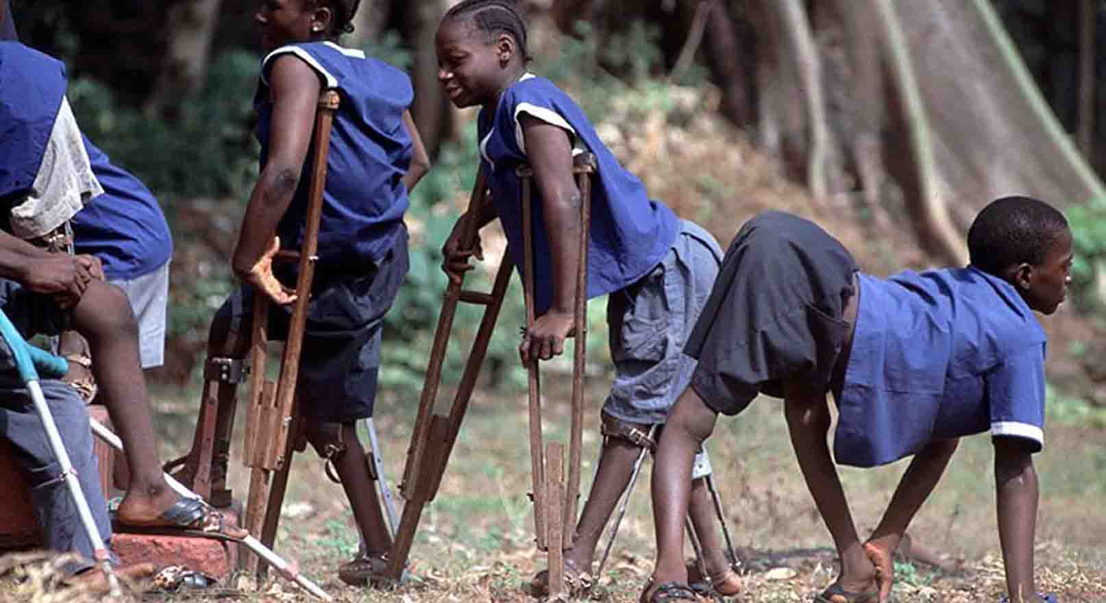 Polio Surfaces In Malaysia After 27 years